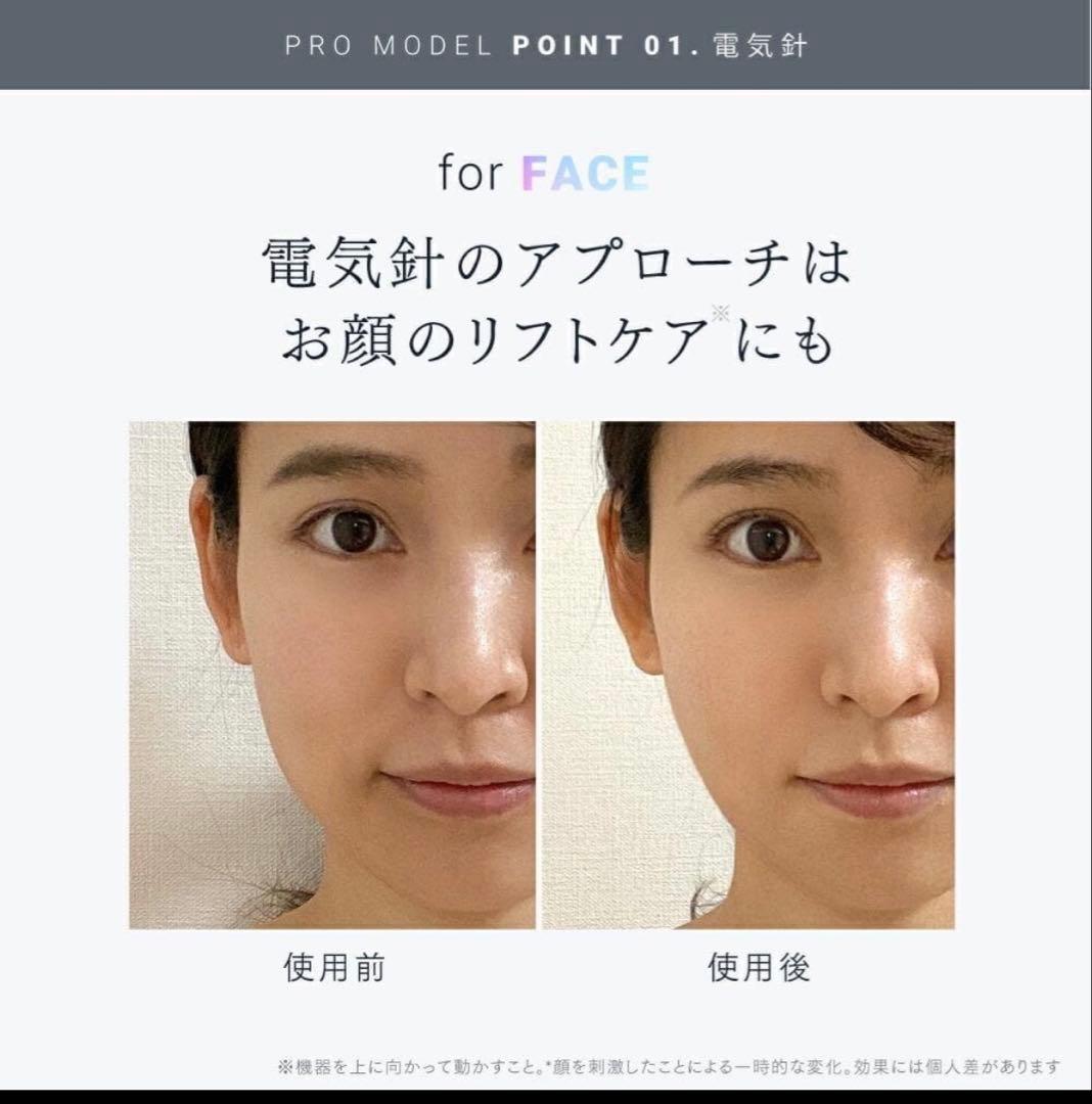 ヘッドスパMYTREX EMS HEADSPA PRO MT-EHP22B