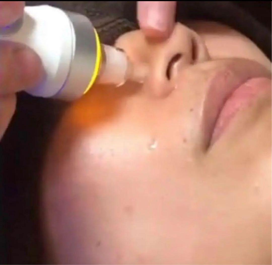 HydraFacial 水素洗浄　ハイドロインパクトプラス