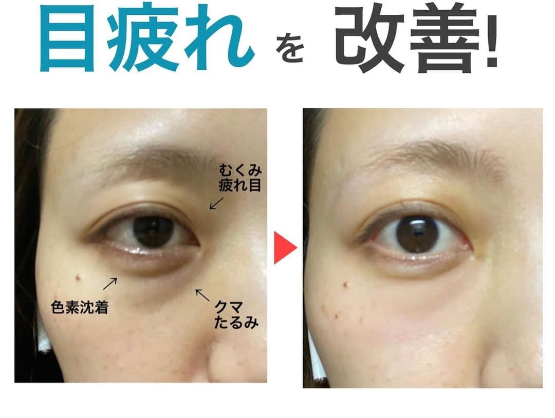 ドットイー 目元専用美顔器