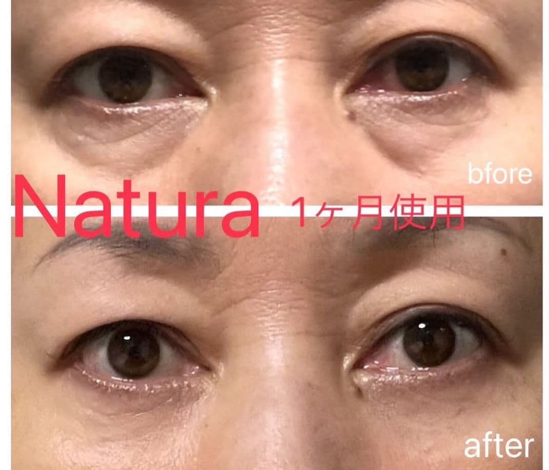 ドットイー 目元専用美顔器